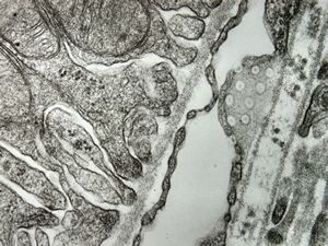 normal kidney - mouse(endothelium and podocyte)